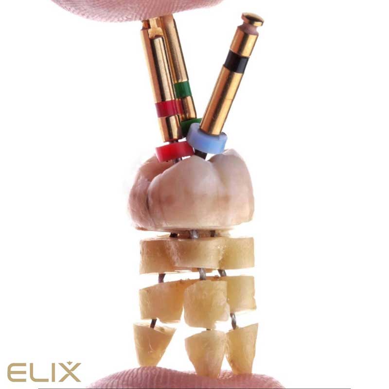 Лечение каналов зуба (Эндодонтия)